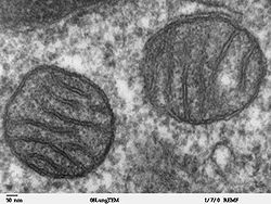 Two mitochondria from mammalian lung tissue
