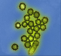 H1N1 influnza virus particles