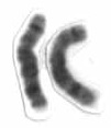 Chromosome 8