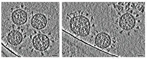 Slices through tomographic reconstructions of SARS-CoV-2 virions