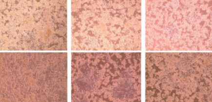 Cytopathic Effects in Uninfected Cell Cultures?